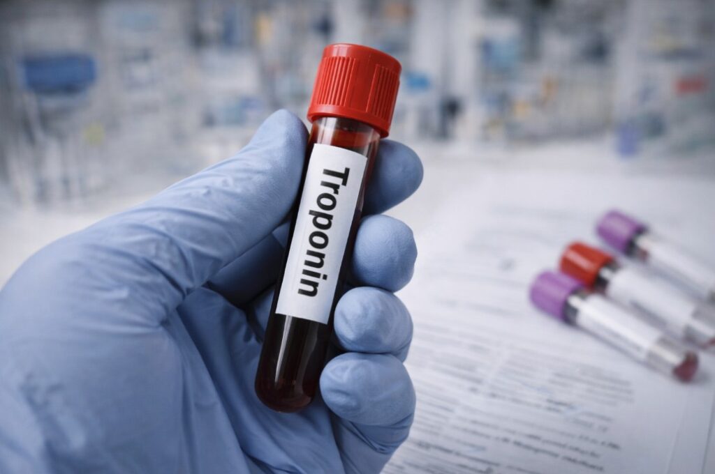 Troponin - Rezultati i nalaz – kako se tumači